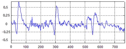 Signal time-domain waveform graphs