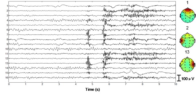 Performance of the algorithm on interictal EEG