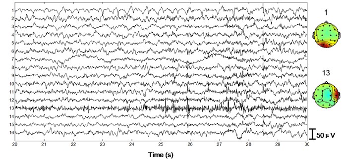 Performance of the algorithm on ictal EEG