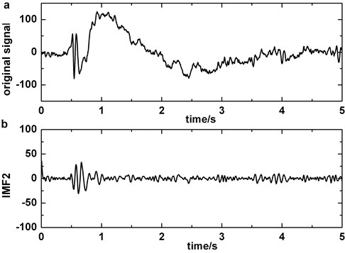 Decomposing of epileptic EEG signal that contains slow-wave by EMD: a) the original epileptic EEG signal which contains slow-wave at about 1 s, b) IMF2, c) IMF3, d) IMF2+IMF3