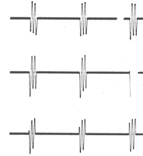 LIM inductors current oscillograms, when the switching time is 14 (a) and 2.5 (b)  periods of industrial electrical mains current