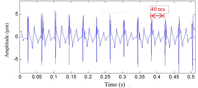 Vibration signal analyzed result with the proposed method