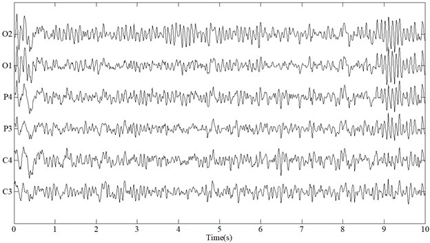 Acquired EEG signals while performing simulated driving tasks in (a) awake and (b) fatigue state