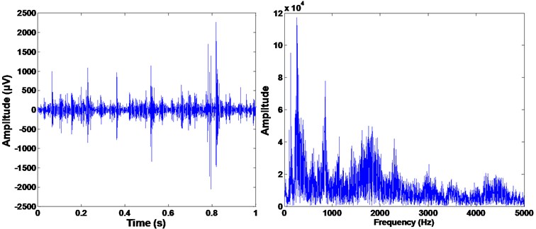 The time and frequency spectra of the compound of cracked and broken teeth