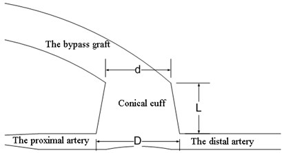 The model of a bypass graft with a cylindrical cuff and the artery (a);  the model of a bypass graft with a conical cuff (b)