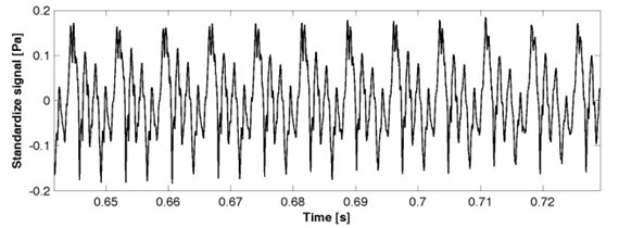 a) Acoustic speech signal, b) vibrations of vocal folds