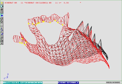 Prosthesis deformation distribution for t= 0.5 sec.