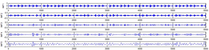Gear signal EEMD results and their corresponding spectrums