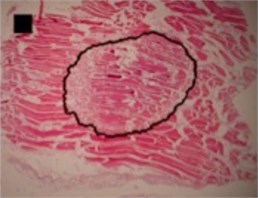 Micrographs of histological samples containing radiofrequency induced necrosis zones on the canine thigh muscle. Contours of ablative lesions are lined in black. Size of scale marker is 1 mm×1 mm