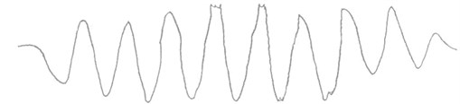The test curves of muzzle vibration displacement before and after the reinforcement of the cradle stiffness