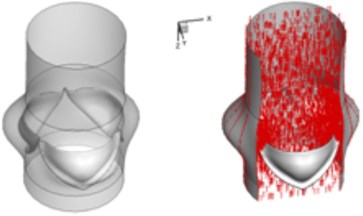 3D complex flow of normal aortic valve
