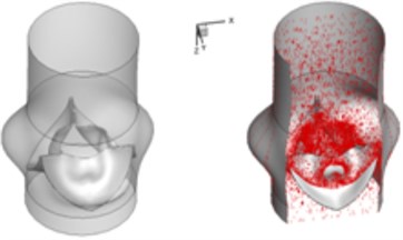 3D complex flow of normal aortic valve