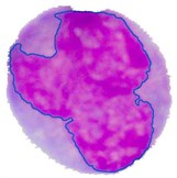 Nucleus/Cytoplasm separation steps: a) original sub-image, b) saturation band,  c) saturation band after histogram equalization, d) resulted image after arithmetic addition  of b) and c), e) binary version of image presented in d), f) seeded region,  g) segmented nucleus boundaries superimposed on the original sub-image