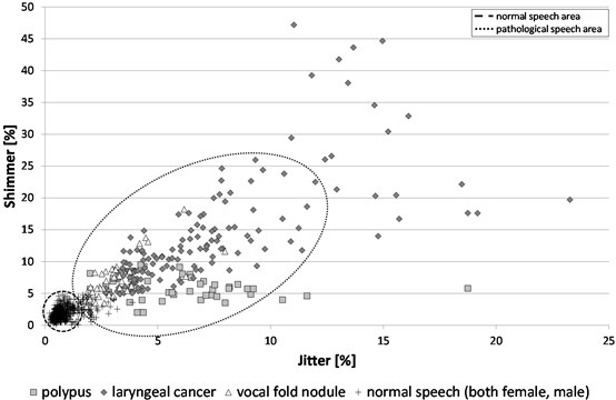 Visualization of Jitter × Shimmer feature for pathological speech  (laryngeal cancer, polypus, vocal fold nodule) and normal speech (both female and male)