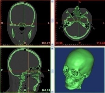 Human body computed tomography (CT) scan images