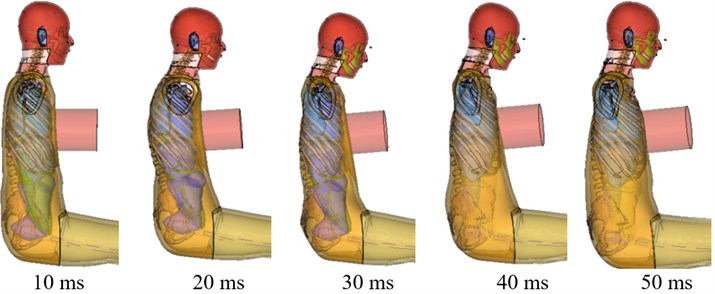 Simulation of chest front impact biomechanical responses, fracture state,  and impact force-deformation curve