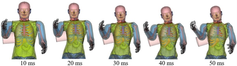 Simulation of chest side impact biomechanical responses, fracture state,  and impact force-deformation curve