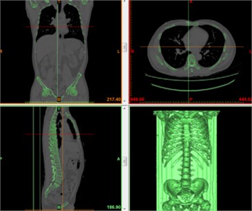 Human body computed tomography (CT) scan images