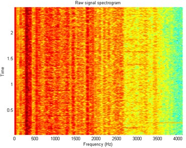 Spectrogram of the acquired signal