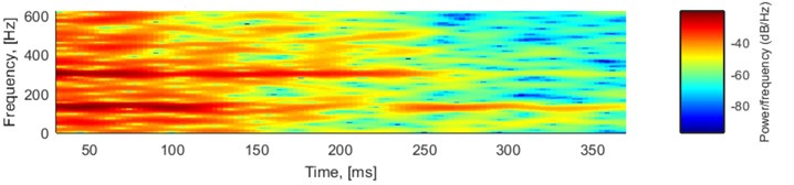 LTI system used for seismic signal simulation: a) impulse response, b) amplitude response, c) phase response (unwrapped) and d) spectrogram of the impulse response (80-sample window, 95 % overlapping)