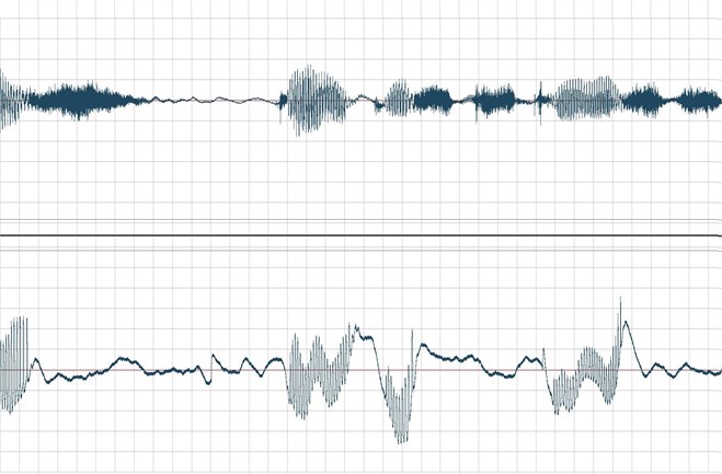 Temporary acoustic signal waveforms (upper) and EGG (bottom graph)