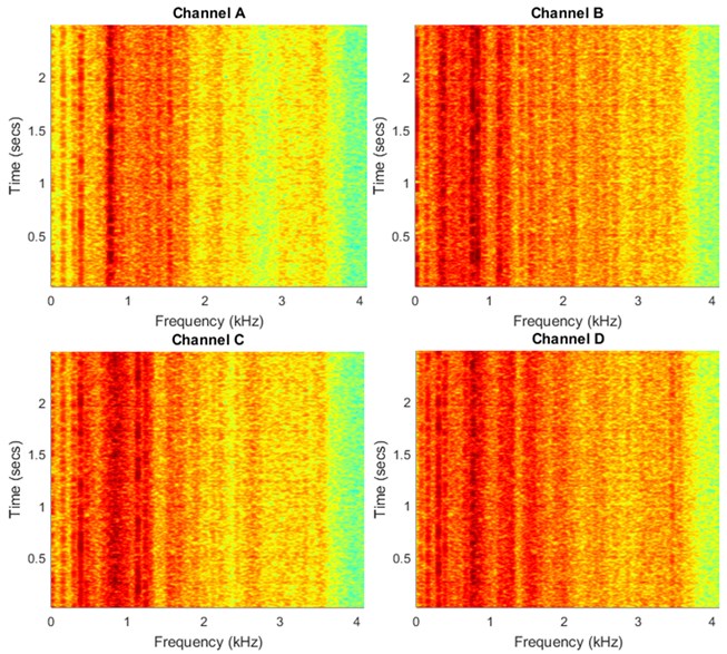 Spectrograms of the multichannel signal