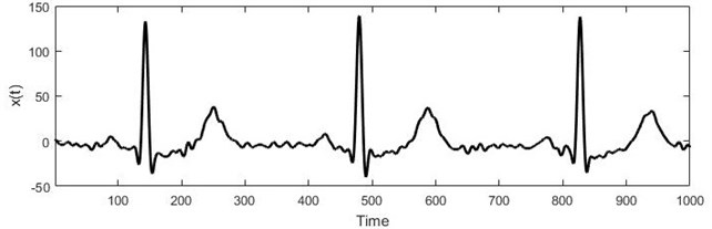 a) Short electrocardiogram signal, b) full electrocardiogram data