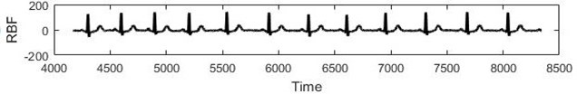 a) Real ECG data, b) RBF forecast, c) Residuals