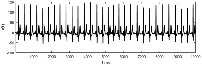 a) Short electrocardiogram signal, b) full electrocardiogram data