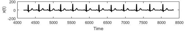 a) Real ECG data, b) RBF forecast, c) Residuals