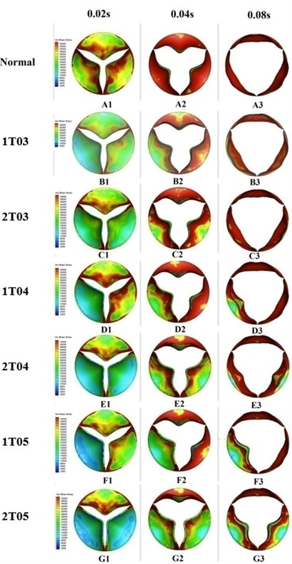 Valve orifice distortion comparison among normal valve and disease valves