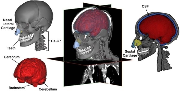 Various components of a subject-specific model of the human  head-neck segmented from CT and MRI data