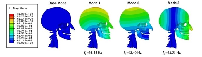 Contour plots of the displacement for the human head-neck complex, indicating their  corresponding frequencies and diverse mode shapes under the undamped vibration circumstances