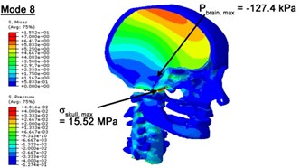 Contour plots of biomechanical responses of human finite element head-neck model,  indicating their vertex values at special important modes