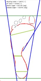 Foot parameters