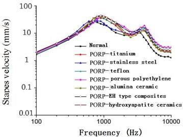 Frequency-response curve of stapes  velocity after replacing PORP (120 dB)