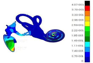 The vibration response of the whole ear after replacing PORP (120 dB)