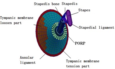 Finite element model of middle ear  after replacing artificial auditory ossicle