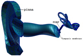 Finite element model of total ear after replacing artificial auditory ossicle