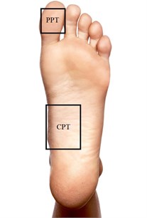 Measurement points: PPT – peripheral point, CPT – central point