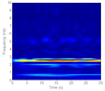 Strain responses at locations #9 with pretension of 35 N under the middle flow