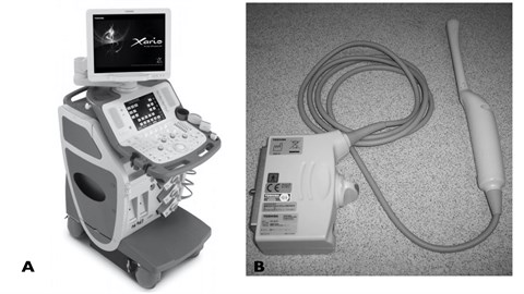 Ultrasound equipment: a) TOSHIBA Xario XG ultrasound mashine and  b) TOSHIBA PVT-661VT endovaginal Ultrasound Probe