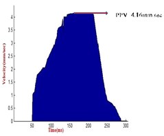 a) Recorded PPV at 500 m distance, b) recorded PPV at 150 m distance, c) recorded PPV  at 300 m distance, d) recorded PPV at 200 m distance, e) recorded PPV at 400 m distance, f) recorded  PPV at 500 m distance, g) recorded PPV at 600 m distance, h) recorded PPV at 750 m distance,  i) recorded PPV at 150 m distance, j) recorded PPV at 500 m distance, k) recorded PPV at 150 m distance