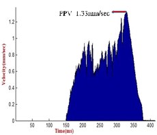 a) Recorded PPV at 500 m distance, b) recorded PPV at 150 m distance, c) recorded PPV  at 300 m distance, d) recorded PPV at 200 m distance, e) recorded PPV at 400 m distance, f) recorded  PPV at 500 m distance, g) recorded PPV at 600 m distance, h) recorded PPV at 750 m distance,  i) recorded PPV at 150 m distance, j) recorded PPV at 500 m distance, k) recorded PPV at 150 m distance