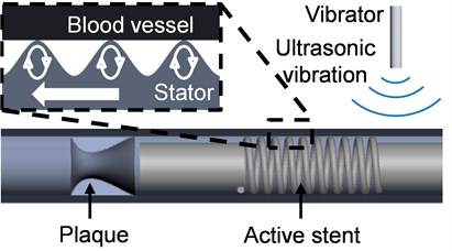 Drive mechanism of active stent
