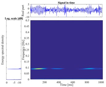 The vibration signal and the time-frequency pseudo-color map of gear faults