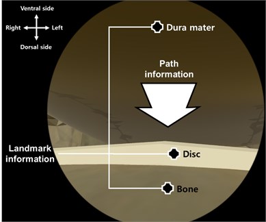 3D geometric information including landmark information (bone, disc, dura mater)  and path information (catheter insertion path)