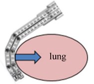 Comparison of conventional