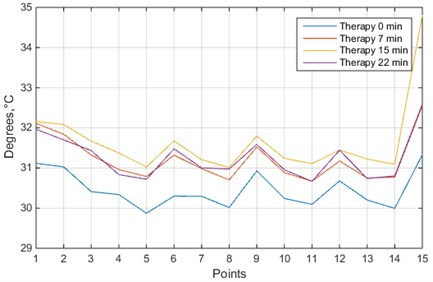 Temperature values of 15 measurement points in hand: blue line – before the therapy;  orange line – during the therapy, after 7 minutes; yellow line – just after the therapy;  purple line – 7 minutes after the therapy