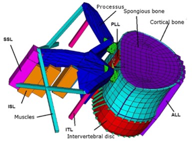 Finite element model of: a) vertebra with precessus, muscles and ligaments, b) intervertebral disc